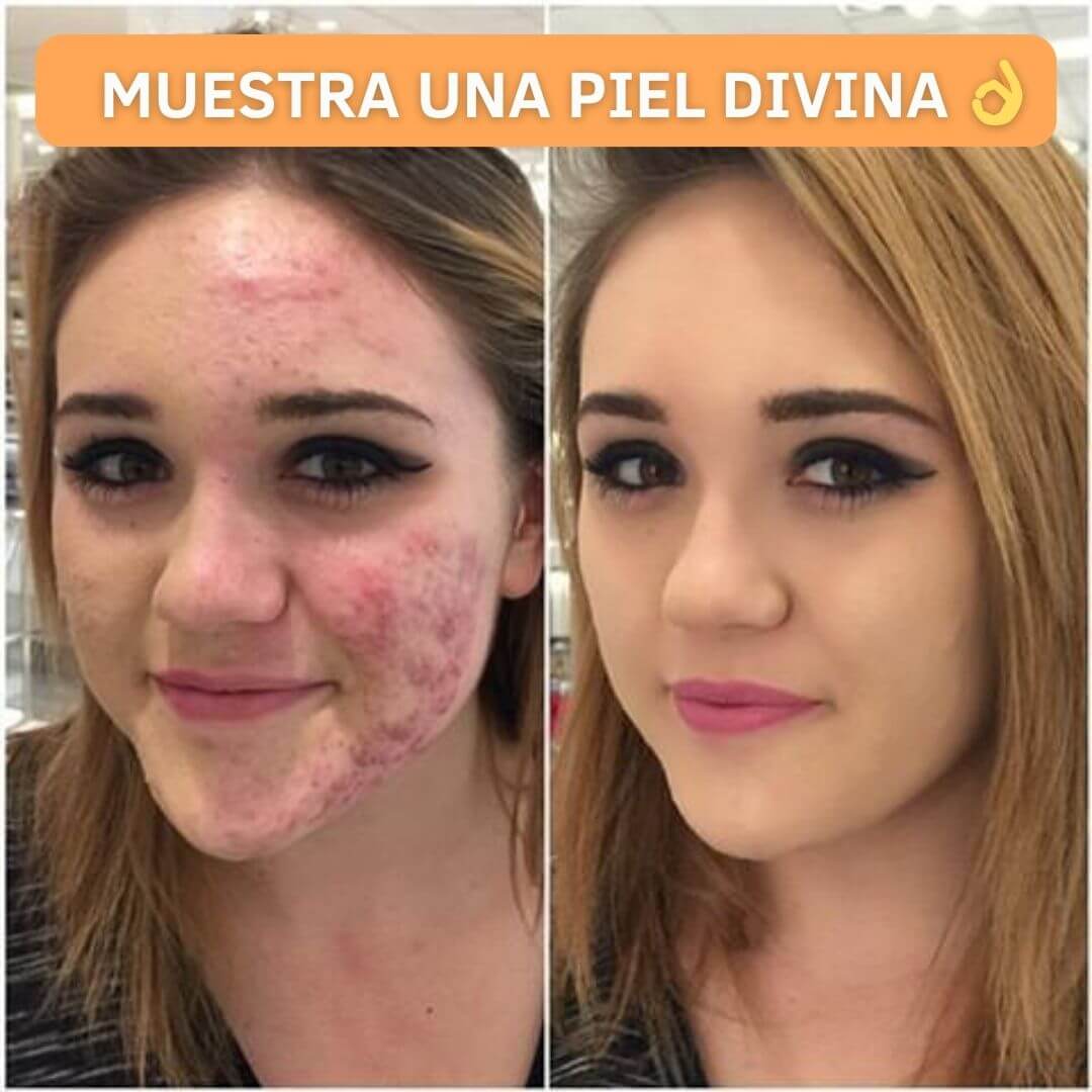 BASE PREMIUM ANGEALA CON VITAMITA C Y PROTECTOR SOLAR