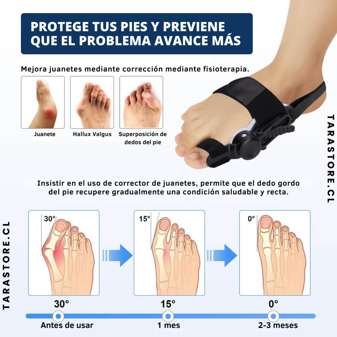 Corrector De Juanetes Alinea y Reducción de Roce