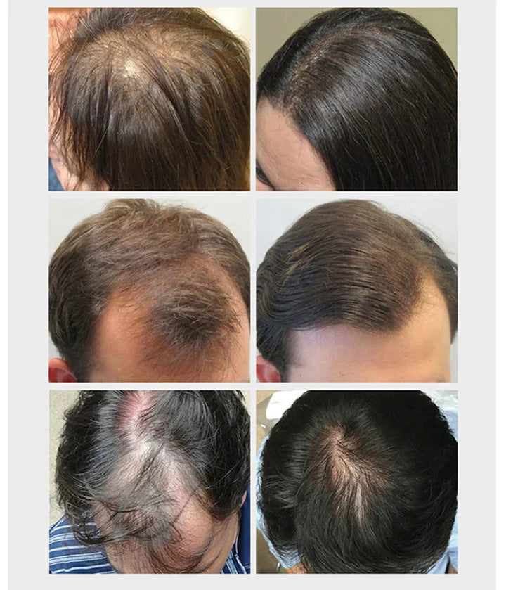 Disaar Hair Care Premium™ Aceite Anticaida Reparador Crecimiento