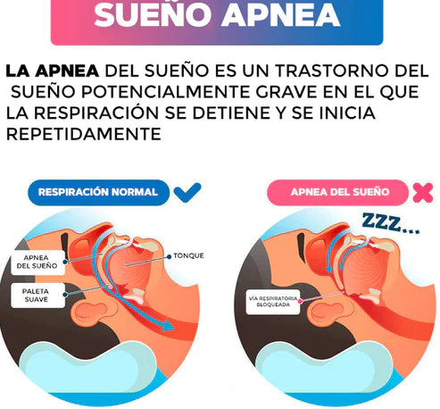 NIGHTRELAX™ Antironquido y Purificador - OFERTA PAGA 1 y LLEVA 2 🔥