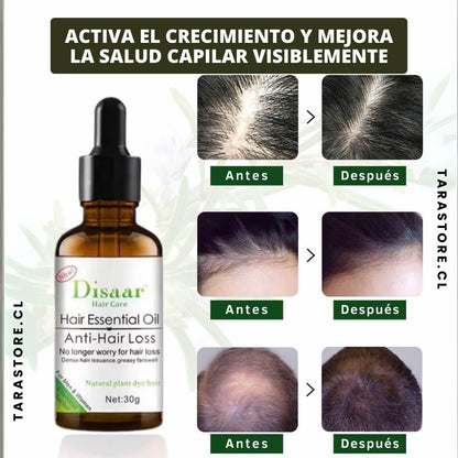 Pack 2 Aceites Tratamiento Anti Caida Recupera y Fortalece tu Cabello