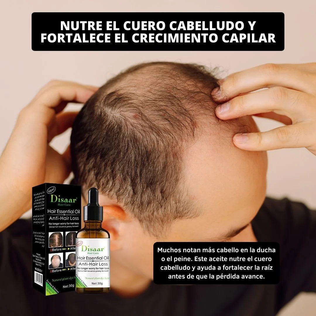 Aceite Anti Caída De Cuero Cabelludo - Fortalece y fomenta el crecimiento