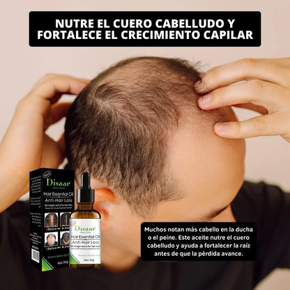 Aceite Anti Caída De Cuero Cabelludo - Fortalece y fomenta el crecimiento