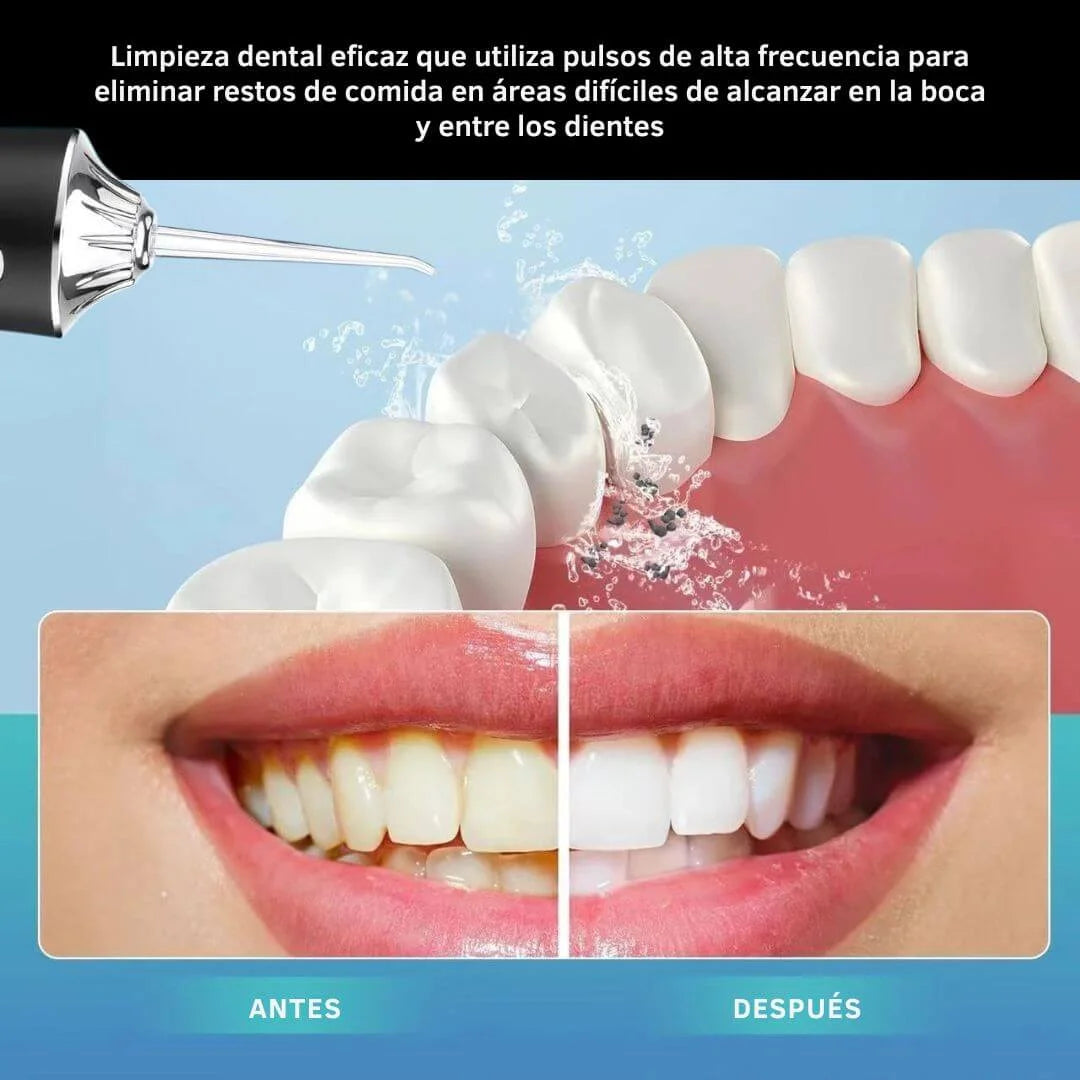 Irrigador Bucal Portátil — Limpieza Profunda Donde el Cepillo No Llega