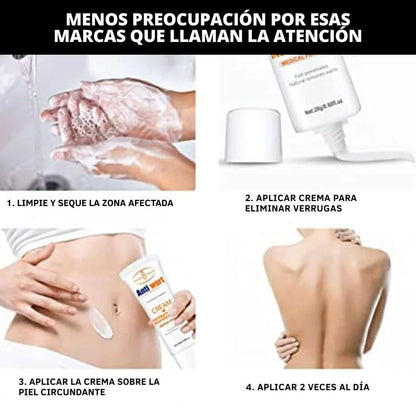 Crema Anti Verrugas Removedor 2x1