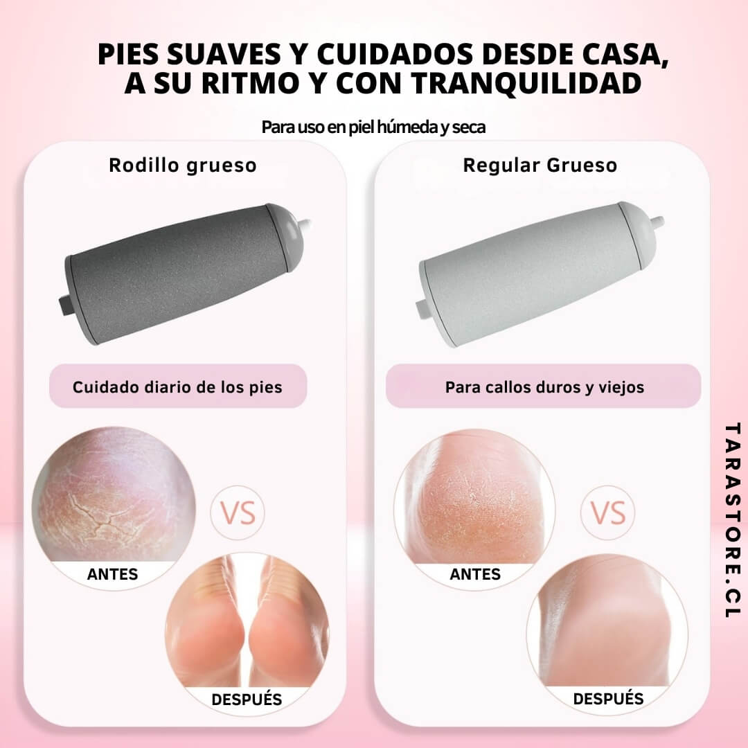 Pulidor Removedor de Callos - Recupera el aspecto y belleza de tus pies