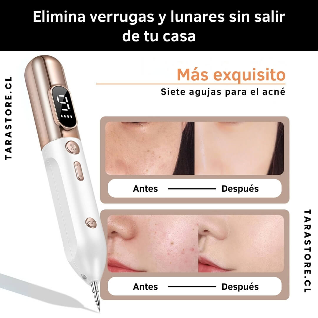 Plasmapen Removedor Verrugas Y Lunar