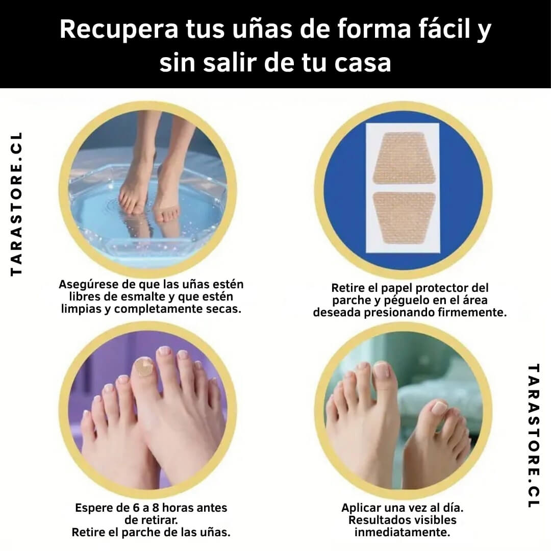 16 Parches Anti Hongos - Recupera y Fortalece Uñas