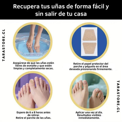 16 Parches Anti Hongos - Recupera y Fortalece Uñas
