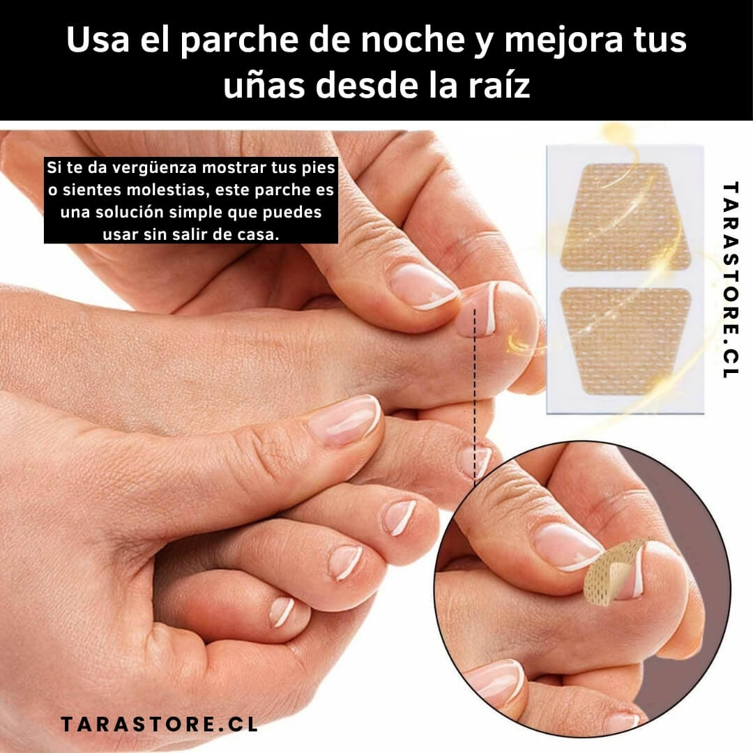 16 Parches Anti Hongos - Recupera y Fortalece Uñas