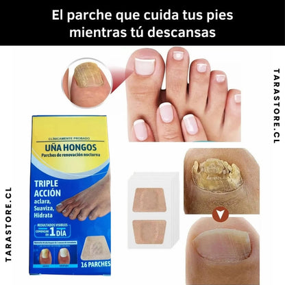 16 Parches Anti Hongos - Recupera y Fortalece Uñas