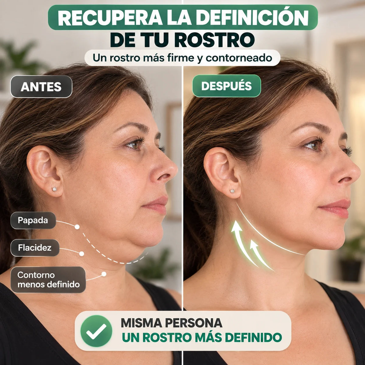 Faja Facial Anti Papada — Firmeza para el Mentón