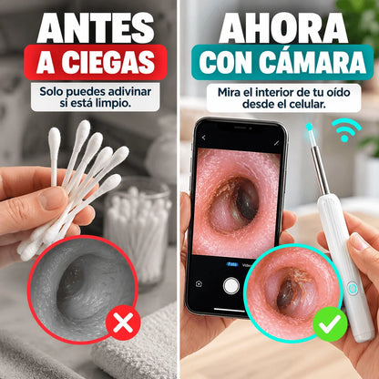 Otoscopio WiFi con Cámara HD y Luz LED — Deja de Limpiar tus Oídos a Ciegas