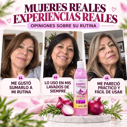 Pack 2 Shampoo Anticaida De Cebolla Y Romero Copacabana