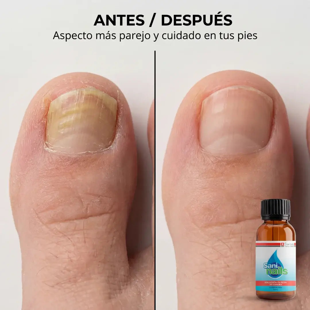SaniNails Formula Natural Para el Cuidado diario de uñas dañadas
