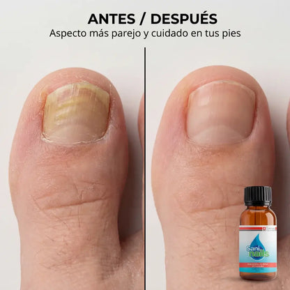 SaniNails Formula Natural Para el Cuidado diario de uñas dañadas
