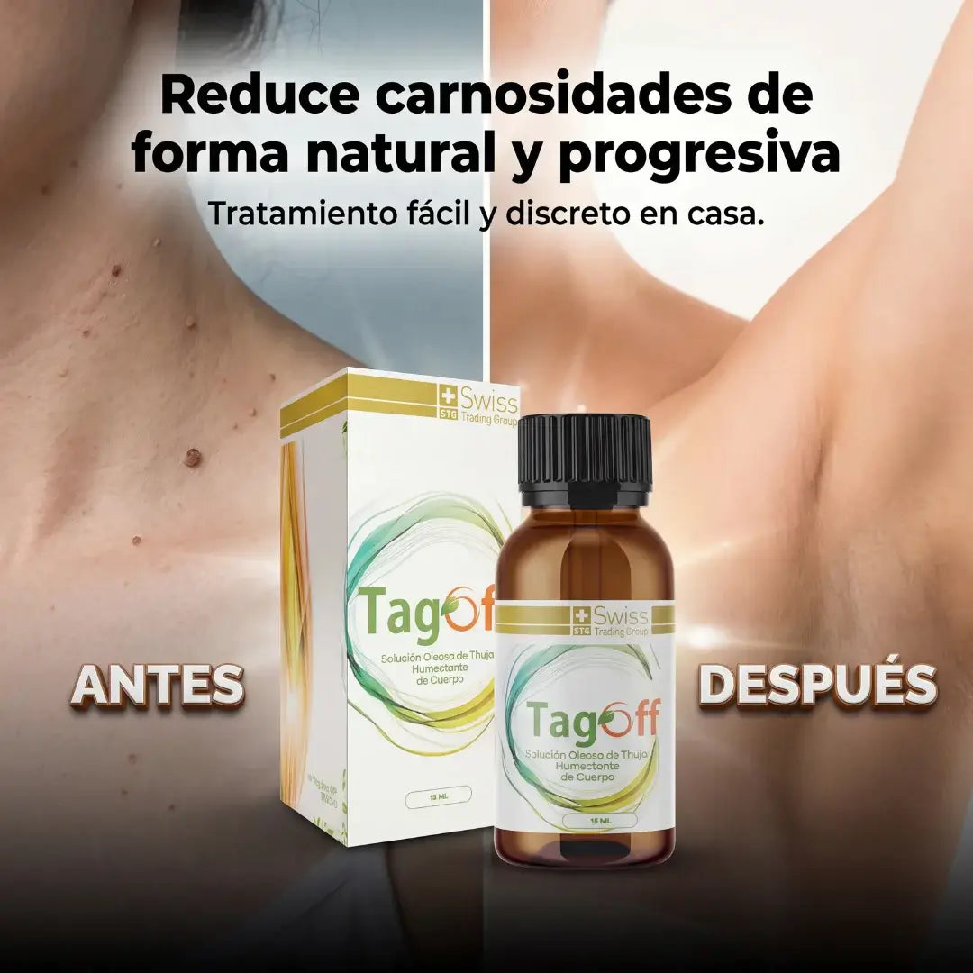 Tag Off Solución Natural Para Verrugas y Carnosidades - Formulado en USA